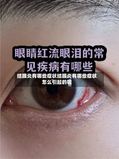 结膜炎有哪些症状结膜炎有哪些症状怎么引起的呢
