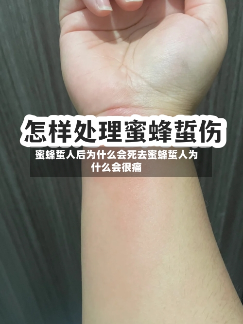 蜜蜂蜇人后为什么会死去蜜蜂蜇人为什么会很痛