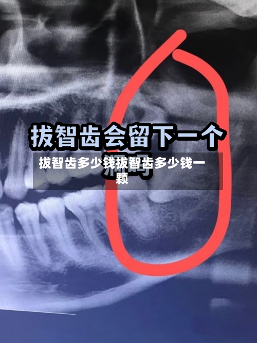 拔智齿多少钱拔智齿多少钱一颗