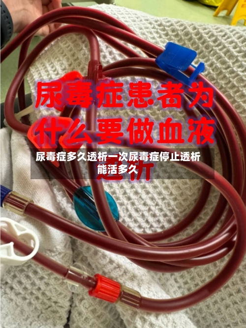尿毒症多久透析一次尿毒症停止透析能活多久